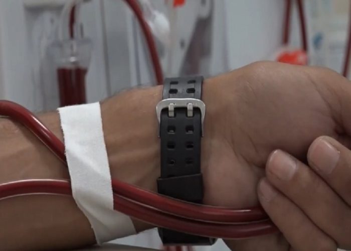 Rreth 600 seanca hemodialize për pacientë nga jashtë vendit